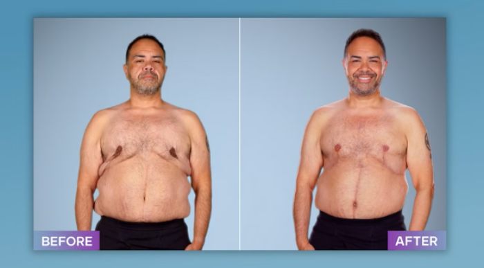 Plastic Surgeon Who Fixes &#8220;Botched&#8221; Operations Goes Viral After Netizens Discover Before-And-After Photos