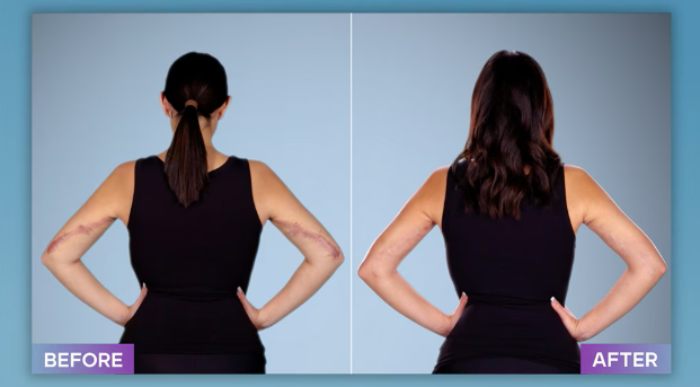 Plastic Surgeon Who Fixes &#8220;Botched&#8221; Operations Goes Viral After Netizens Discover Before-And-After Photos