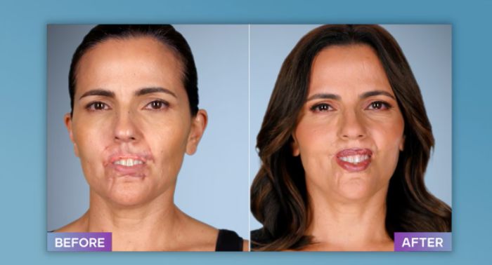 Plastic Surgeon Who Fixes &#8220;Botched&#8221; Operations Goes Viral After Netizens Discover Before-And-After Photos