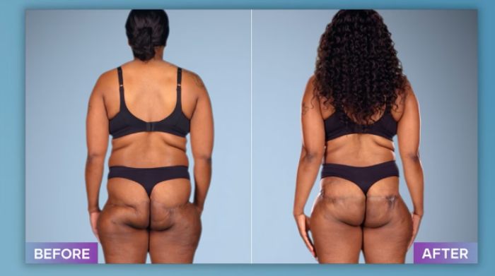 Plastic Surgeon Who Fixes &#8220;Botched&#8221; Operations Goes Viral After Netizens Discover Before-And-After Photos