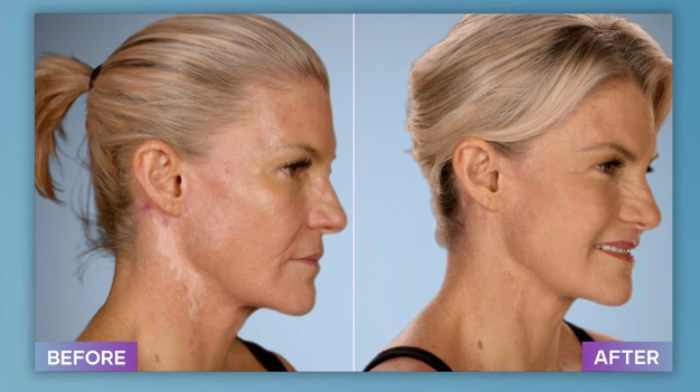 Plastic Surgeon Who Fixes &#8220;Botched&#8221; Operations Goes Viral After Netizens Discover Before-And-After Photos