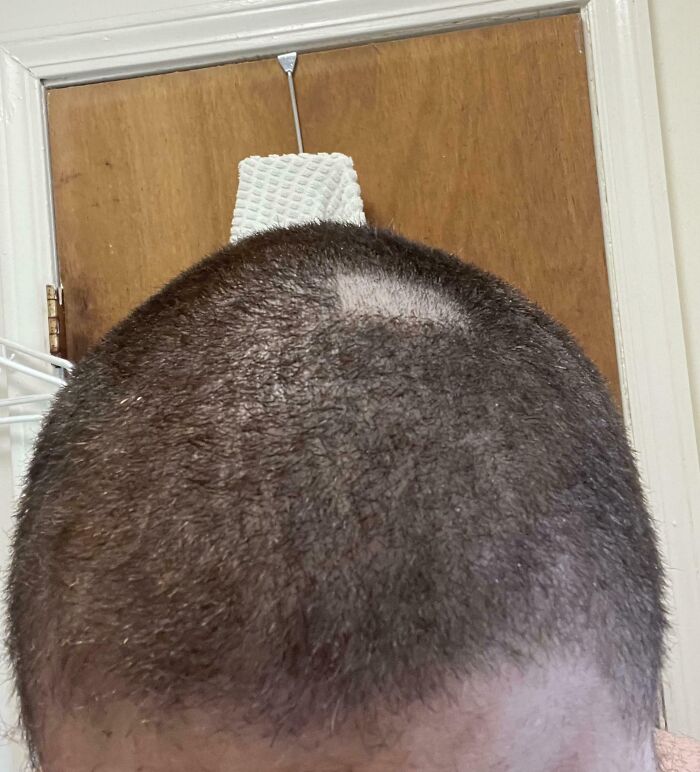 62 Times People Forgot Something And Ended Up In Funny Unfortunate Situations (New Pics)