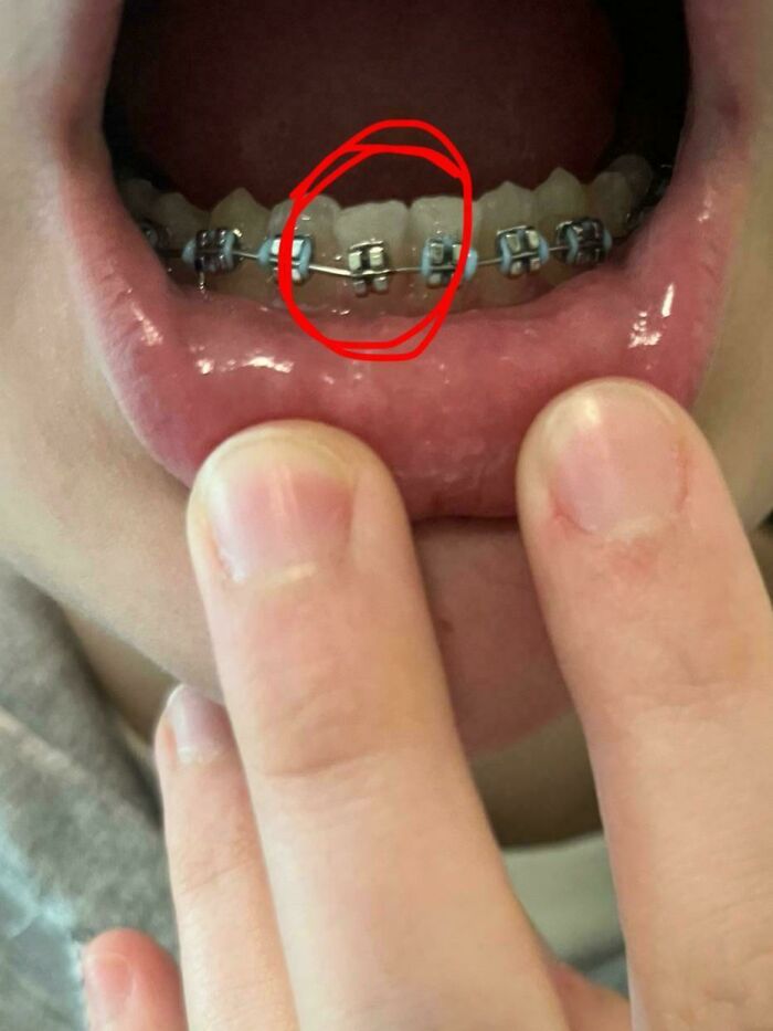 62 Times People Forgot Something And Ended Up In Funny Unfortunate Situations (New Pics)