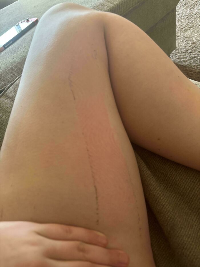 62 Times People Forgot Something And Ended Up In Funny Unfortunate Situations (New Pics)