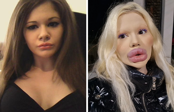 20 Ordinary Lives Changed By Extreme Plastic Surgery