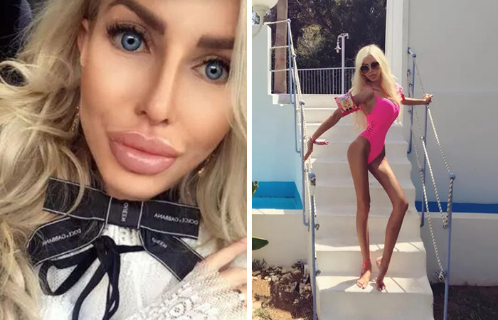20 Ordinary Lives Changed By Extreme Plastic Surgery