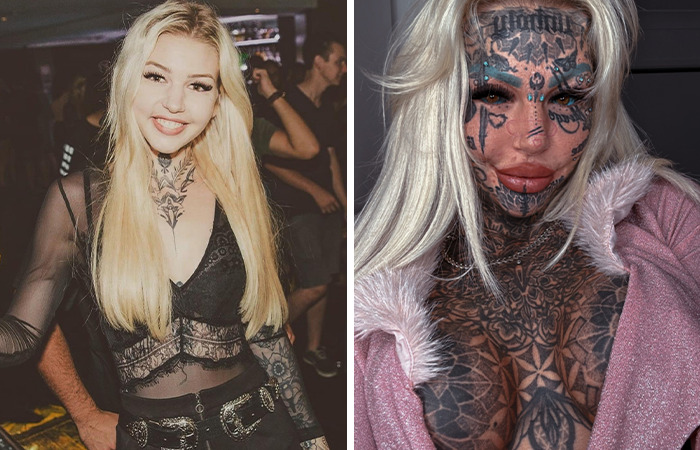 20 Ordinary Lives Changed By Extreme Plastic Surgery