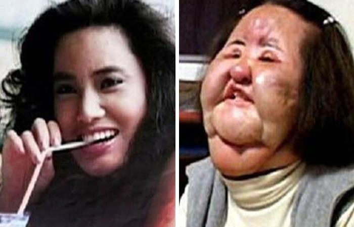 20 Ordinary Lives Changed By Extreme Plastic Surgery