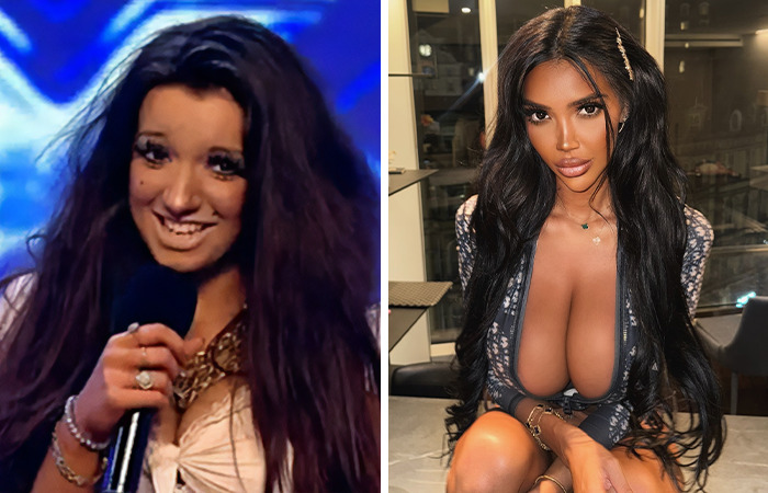 20 Ordinary Lives Changed By Extreme Plastic Surgery