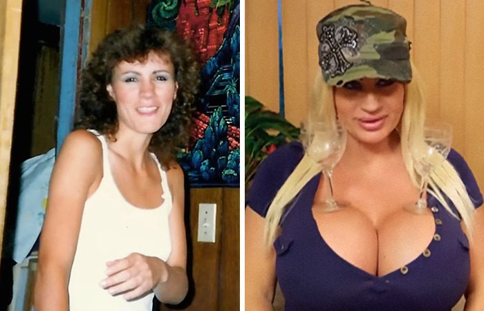 20 Ordinary Lives Changed By Extreme Plastic Surgery