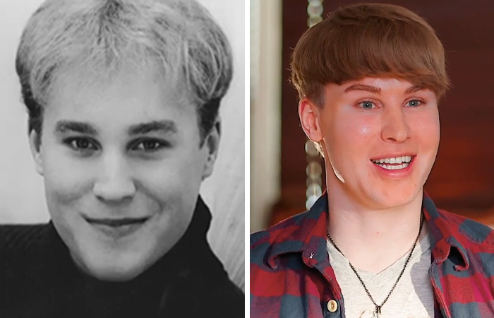 20 Ordinary Lives Changed By Extreme Plastic Surgery