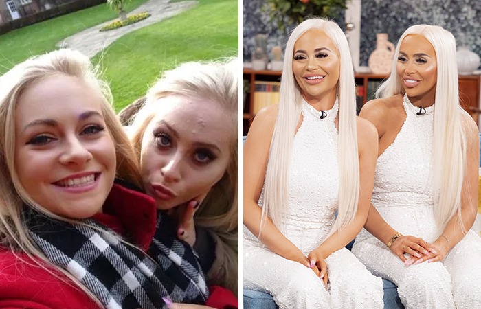 20 Ordinary Lives Changed By Extreme Plastic Surgery