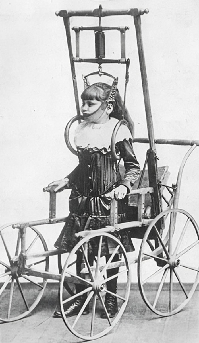29 Unsettling Medical Devices From The Past That Might Make You Appreciate Modern Medicine 29 Unsettling Medical Devices From The Past That Might Make You Appreciate Modern Medicine