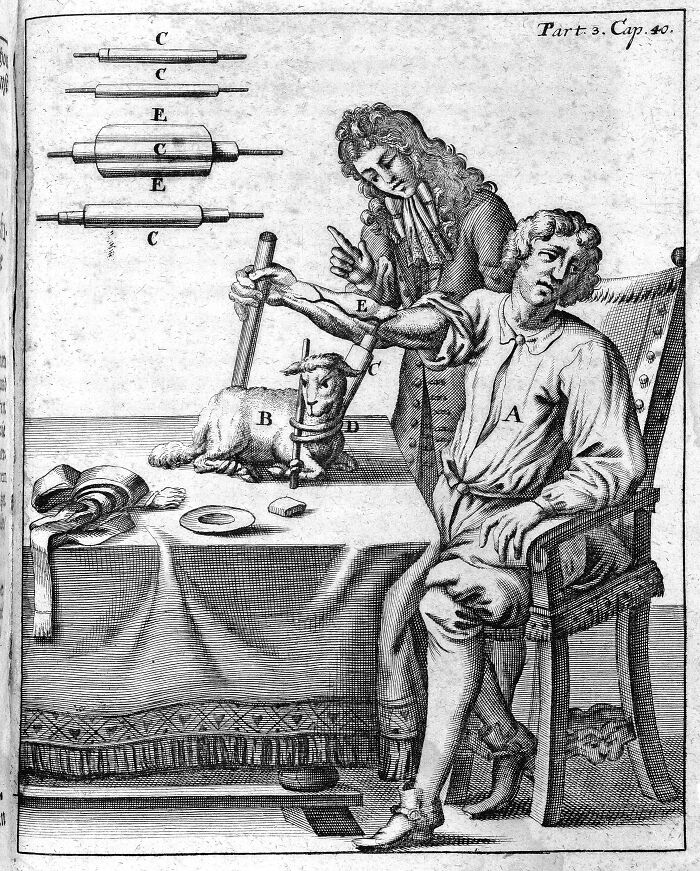 29 Unsettling Medical Devices From The Past That Might Make You Appreciate Modern Medicine 29 Unsettling Medical Devices From The Past That Might Make You Appreciate Modern Medicine