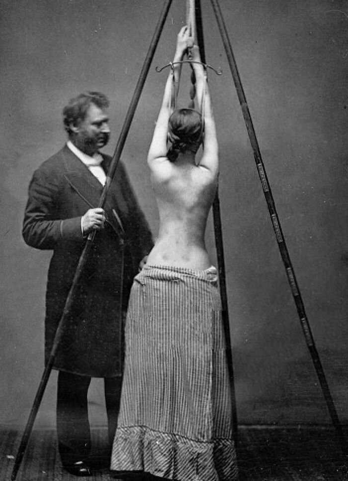 29 Unsettling Medical Devices From The Past That Might Make You Appreciate Modern Medicine 29 Unsettling Medical Devices From The Past That Might Make You Appreciate Modern Medicine