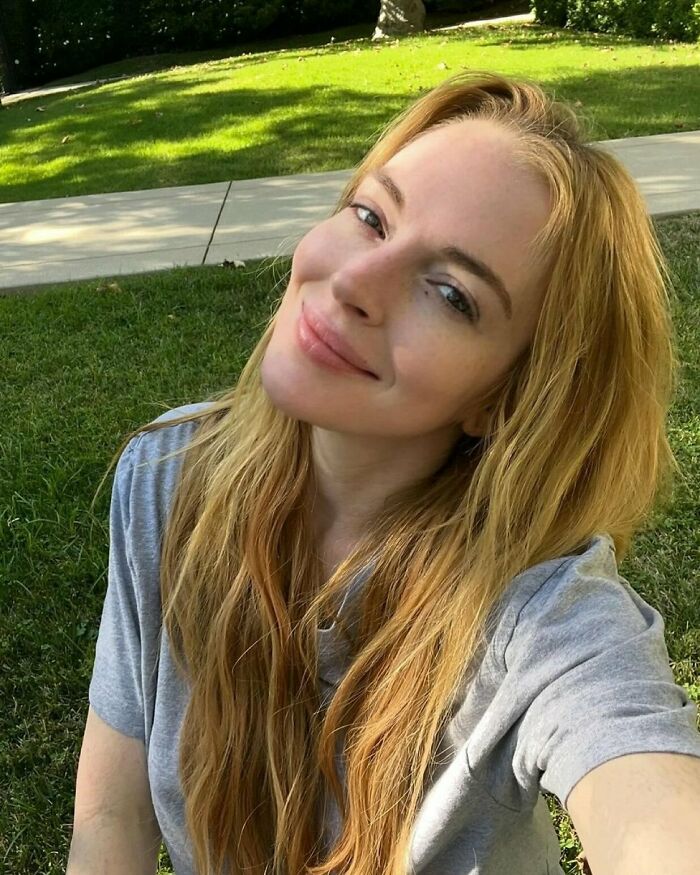 &#8220;10 Years Younger&#8221;: Experts Weigh In On Lindsay Lohan’s Fresh-Faced Glow Amid Plastic Surgery Drama