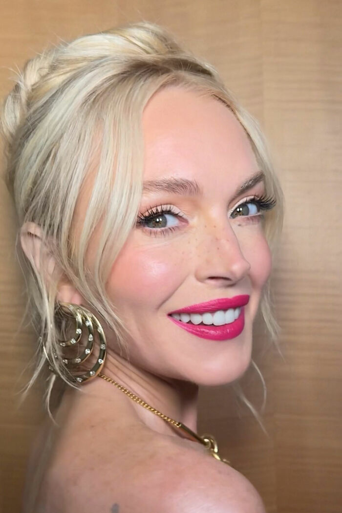 &#8220;10 Years Younger&#8221;: Experts Weigh In On Lindsay Lohan’s Fresh-Faced Glow Amid Plastic Surgery Drama