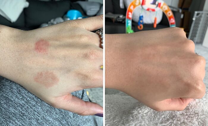 If You’ve Ever Been Personally Victimized By Your Own Body, These 19 Finds Are For You If You’ve Ever Been Personally Victimized By Your Own Body, These 19 Finds Are For You