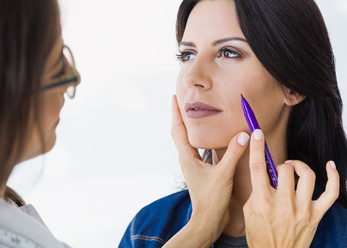 “I’m Honestly Terrified”: 28YO Gets A Facelift, People Are Questioning Reality