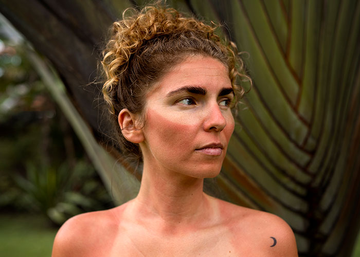 “I’m Honestly Terrified”: 28YO Gets A Facelift, People Are Questioning Reality