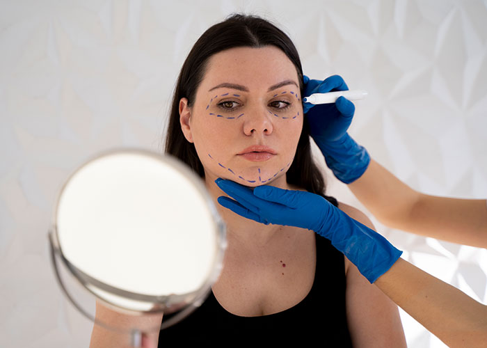 “I’m Honestly Terrified”: 28YO Gets A Facelift, People Are Questioning Reality