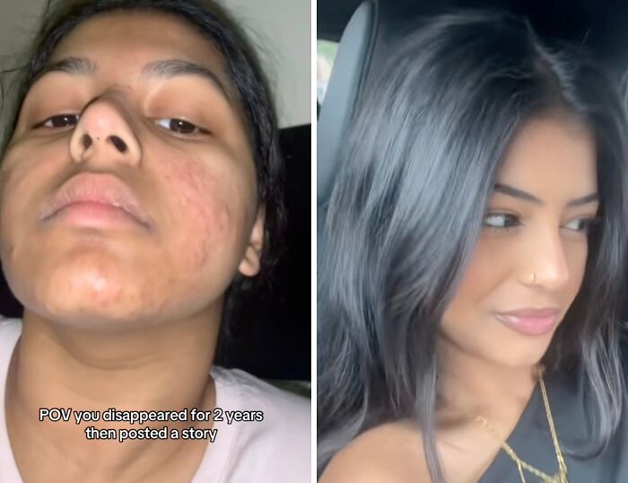 80 Glow-Ups People Are Proud Of And Wanted To Share