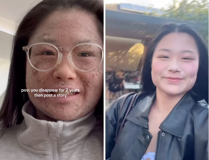 80 Glow-Ups People Are Proud Of And Wanted To Share