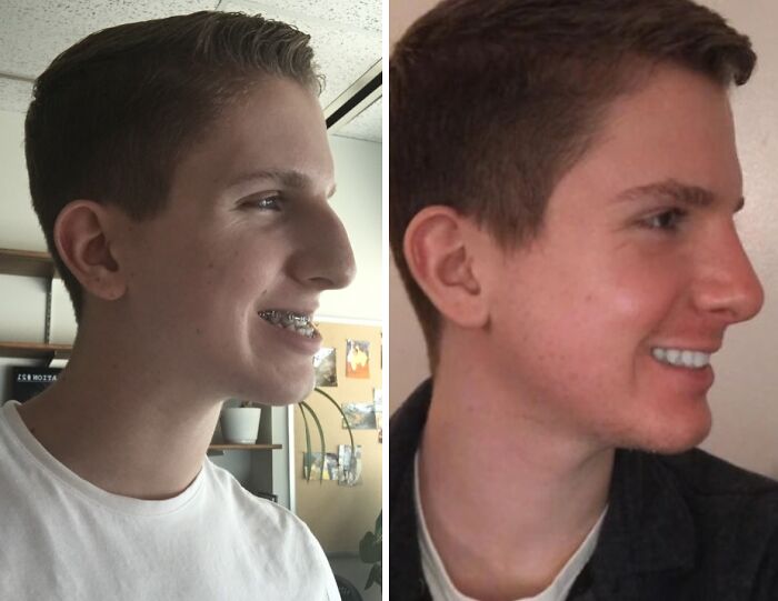 80 Plastic Surgery Transformations That Changed Ordinary Lives Forever