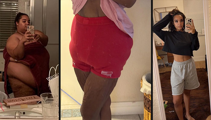 80 Plastic Surgery Transformations That Changed Ordinary Lives Forever