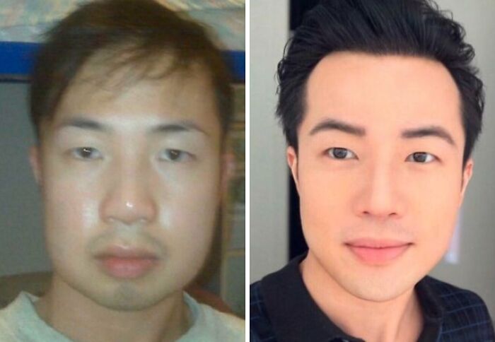 80 Plastic Surgery Transformations That Changed Ordinary Lives Forever