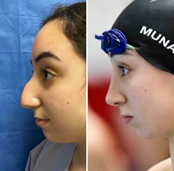 80 Plastic Surgery Transformations That Changed Ordinary Lives Forever