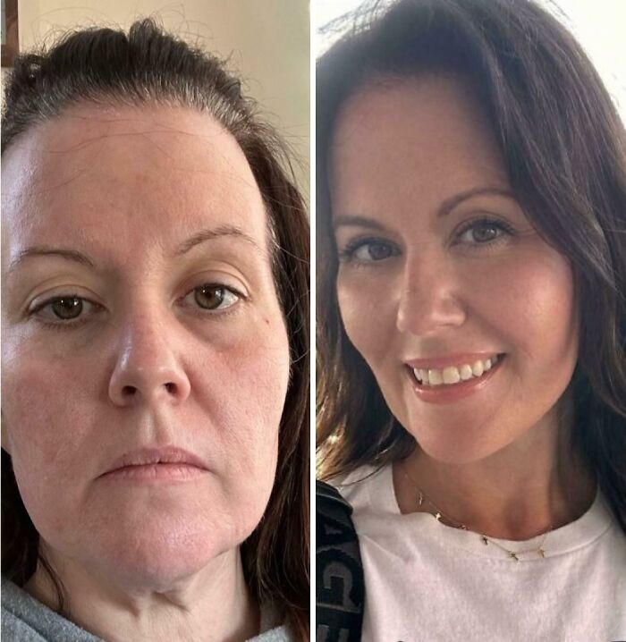 80 Plastic Surgery Transformations That Changed Ordinary Lives Forever