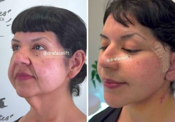 80 Plastic Surgery Transformations That Changed Ordinary Lives Forever