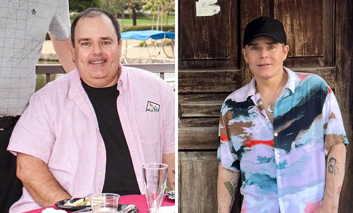 80 Plastic Surgery Transformations That Changed Ordinary Lives Forever