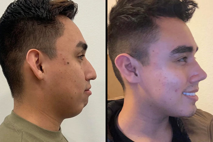 80 Plastic Surgery Transformations That Changed Ordinary Lives Forever