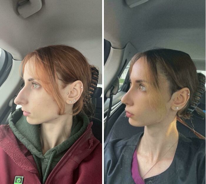 80 Plastic Surgery Transformations That Changed Ordinary Lives Forever