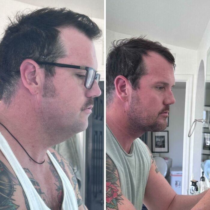 80 Plastic Surgery Transformations That Changed Ordinary Lives Forever