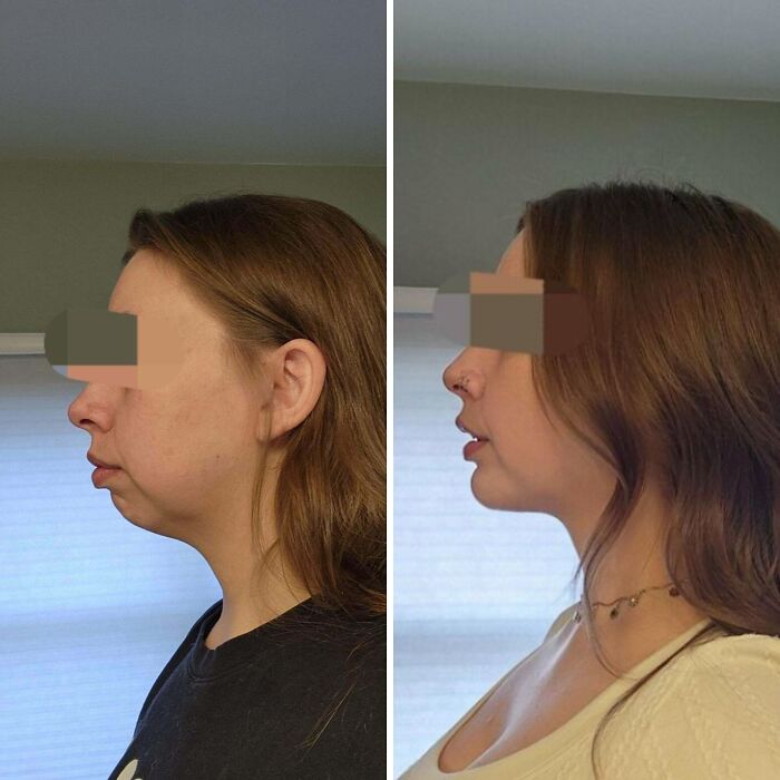 80 Plastic Surgery Transformations That Changed Ordinary Lives Forever