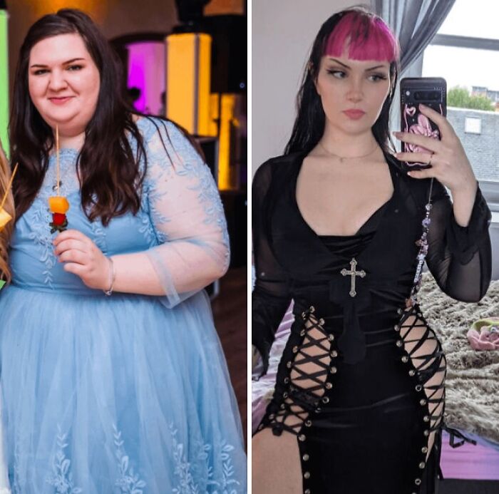 80 Plastic Surgery Transformations That Changed Ordinary Lives Forever