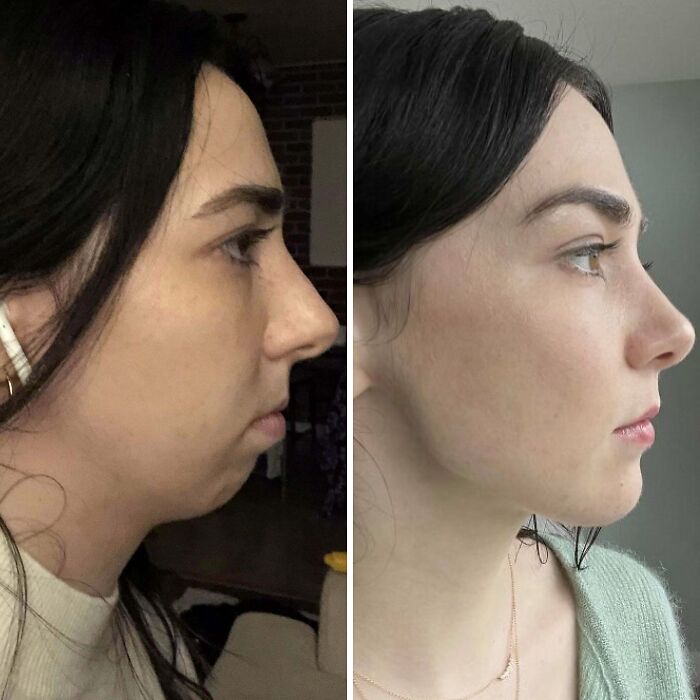 80 Plastic Surgery Transformations That Changed Ordinary Lives Forever