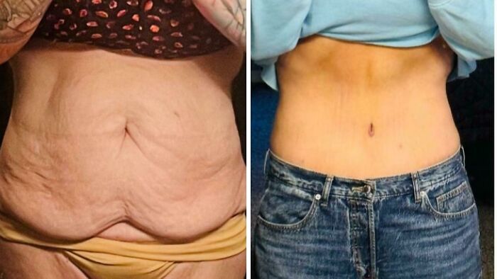 80 Plastic Surgery Transformations That Changed Ordinary Lives Forever