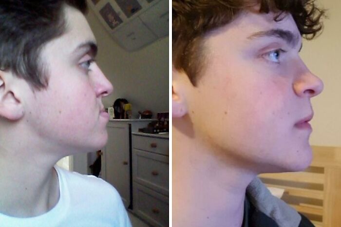 80 Plastic Surgery Transformations That Changed Ordinary Lives Forever