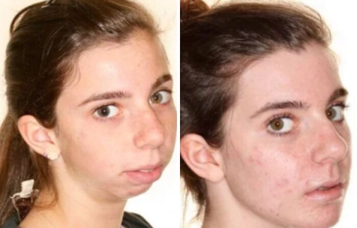 80 Plastic Surgery Transformations That Changed Ordinary Lives Forever