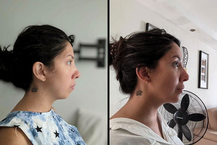 80 Plastic Surgery Transformations That Changed Ordinary Lives Forever