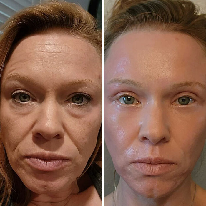 80 Plastic Surgery Transformations That Changed Ordinary Lives Forever
