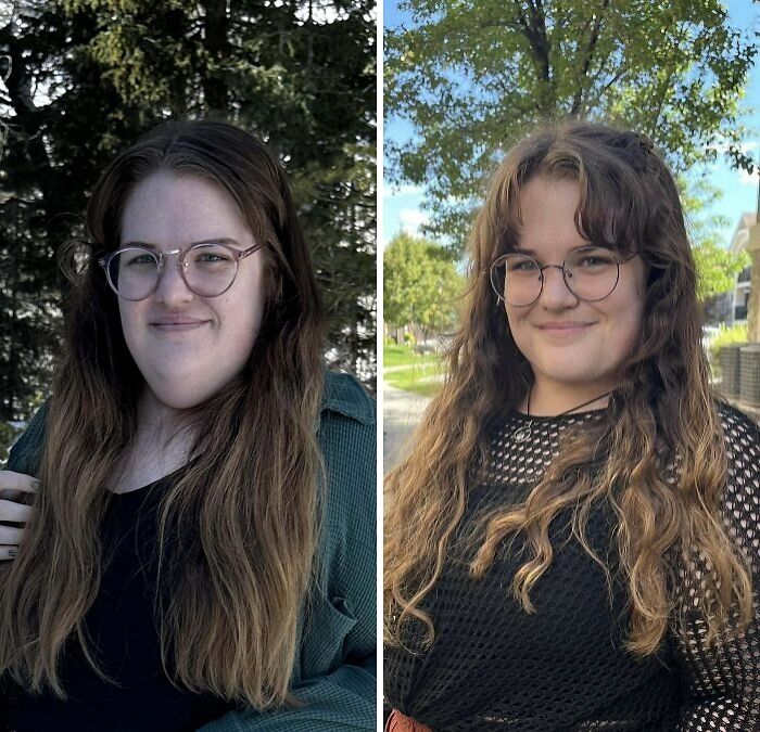 80 Plastic Surgery Transformations That Changed Ordinary Lives Forever