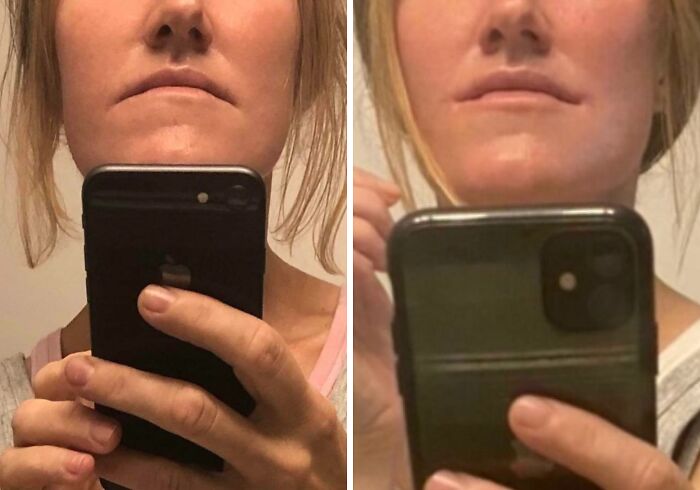 80 Plastic Surgery Transformations That Changed Ordinary Lives Forever