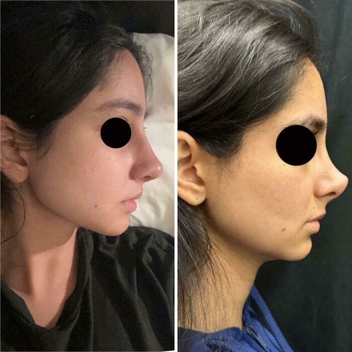80 Plastic Surgery Transformations That Changed Ordinary Lives Forever