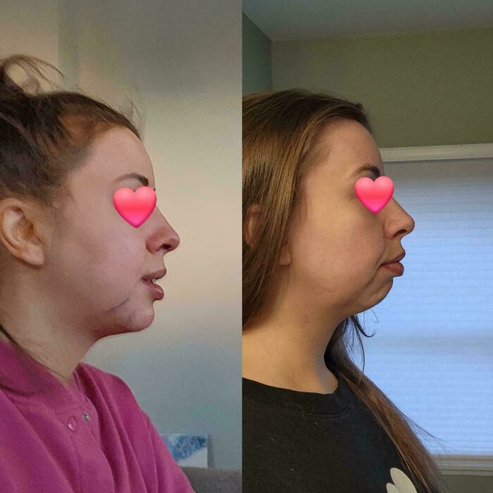 80 Plastic Surgery Transformations That Changed Ordinary Lives Forever
