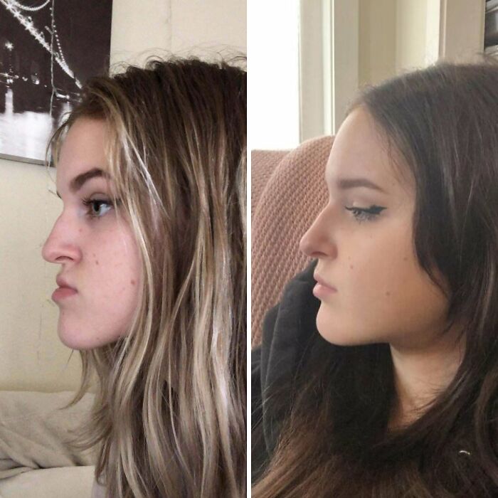 80 Plastic Surgery Transformations That Changed Ordinary Lives Forever